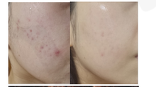 Load image into Gallery viewer, [THE CHEONG AN BIO] Clear Skin Start Bar
